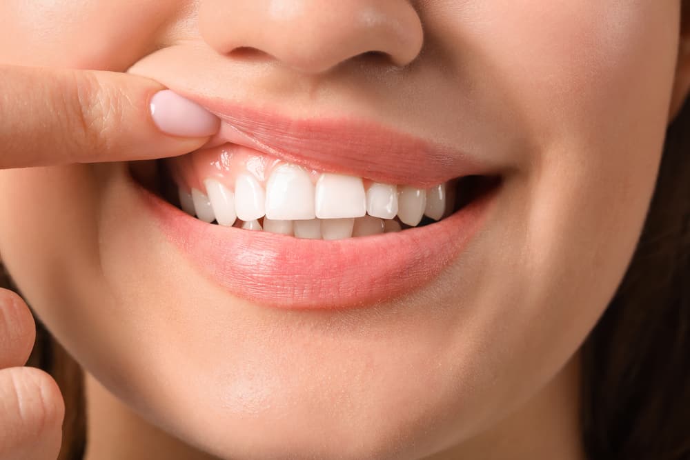 healthy oral health
