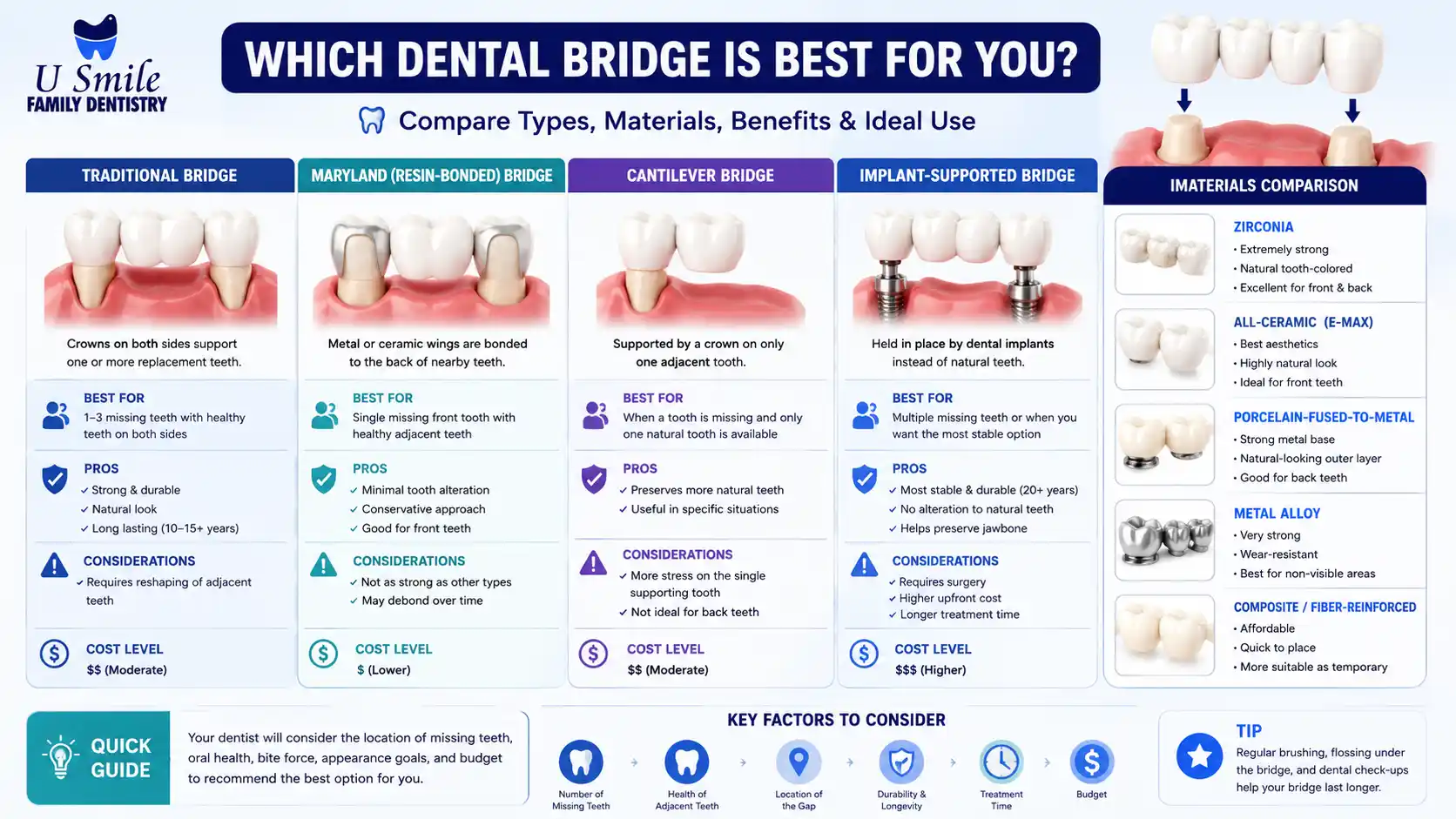 complete infographic which type of dental bridge is best complete