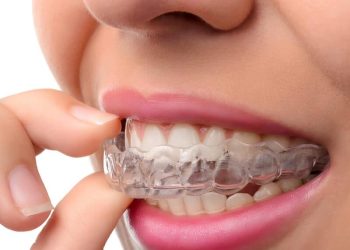 6036ba0b904d993b851b6618_g-invisalign-step-3